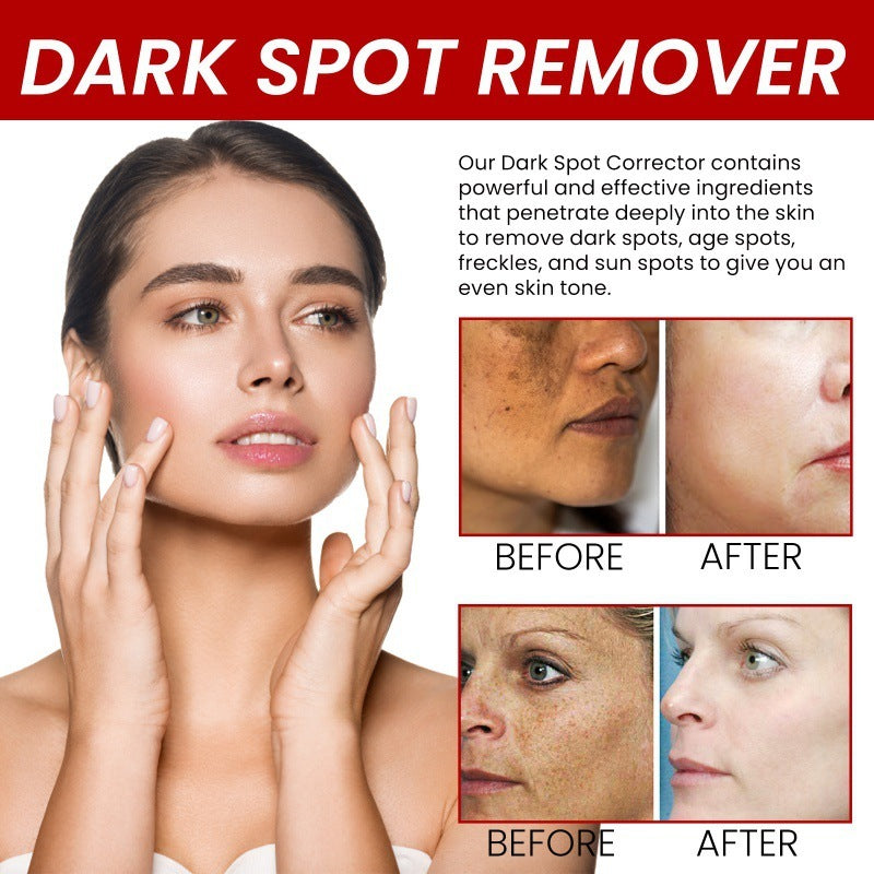 Hydrating And Whitening Facial Fine Lines Removing Cream