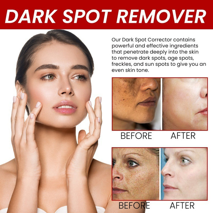 Hydrating And Whitening Facial Fine Lines Removing Cream