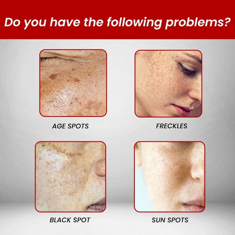 Hydrating And Whitening Facial Fine Lines Removing Cream
