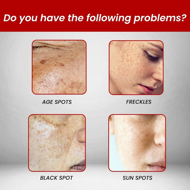 Hydrating And Whitening Facial Fine Lines Removing Cream